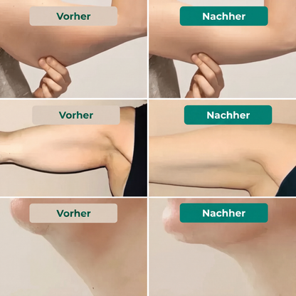 LYMPHDRAINAGE