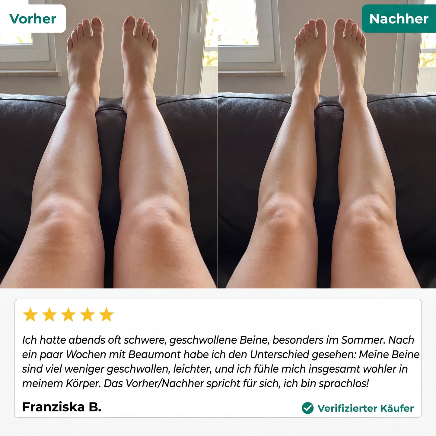 LYMPHDRAINAGE