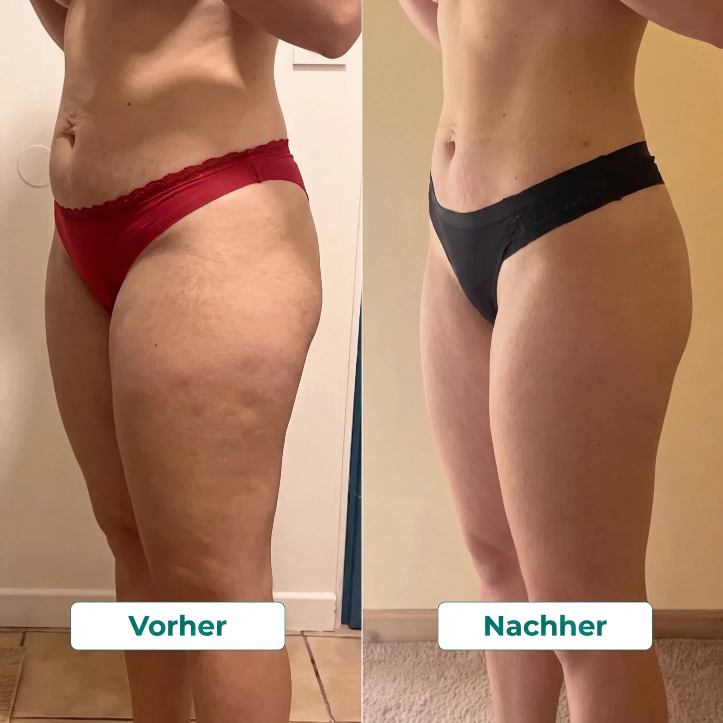 LYMPHDRAINAGE